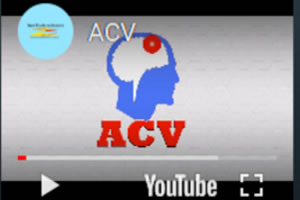 4 acv video